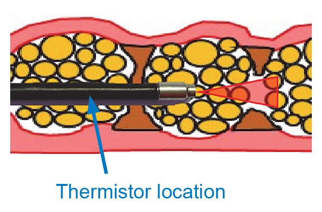 thermistor-cosmetic-laser-surgery